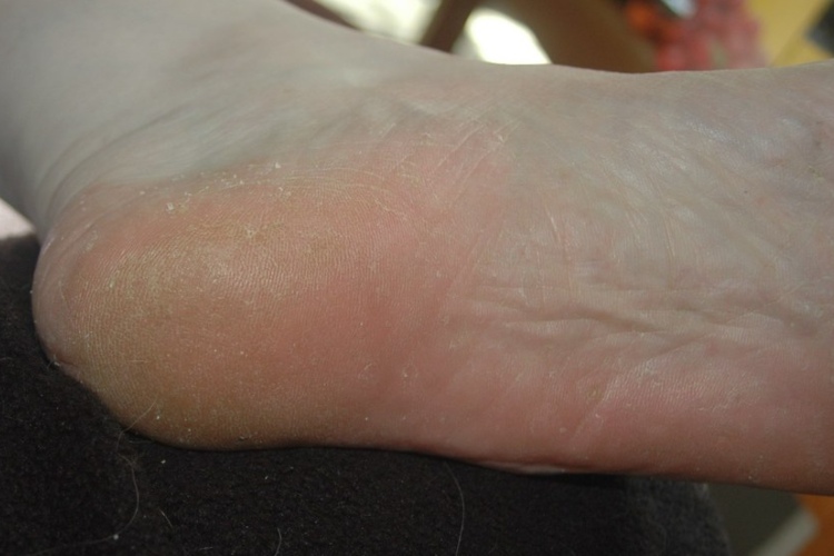 The Many Unconventional Ways That Toothpaste Can Save You Big Bucks