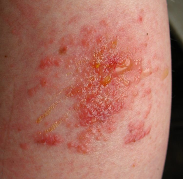 These Are Awesome Baking Soda Hacks You Didn't Know About Nonstop