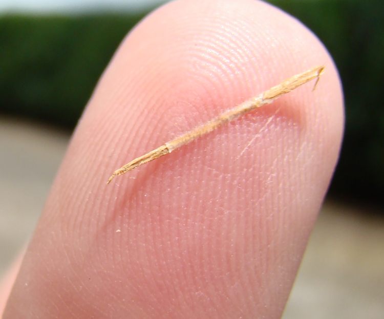 These Are Awesome Baking Soda Hacks You Didn't Know About Nonstop